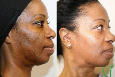 Renewal Facial Cleanser