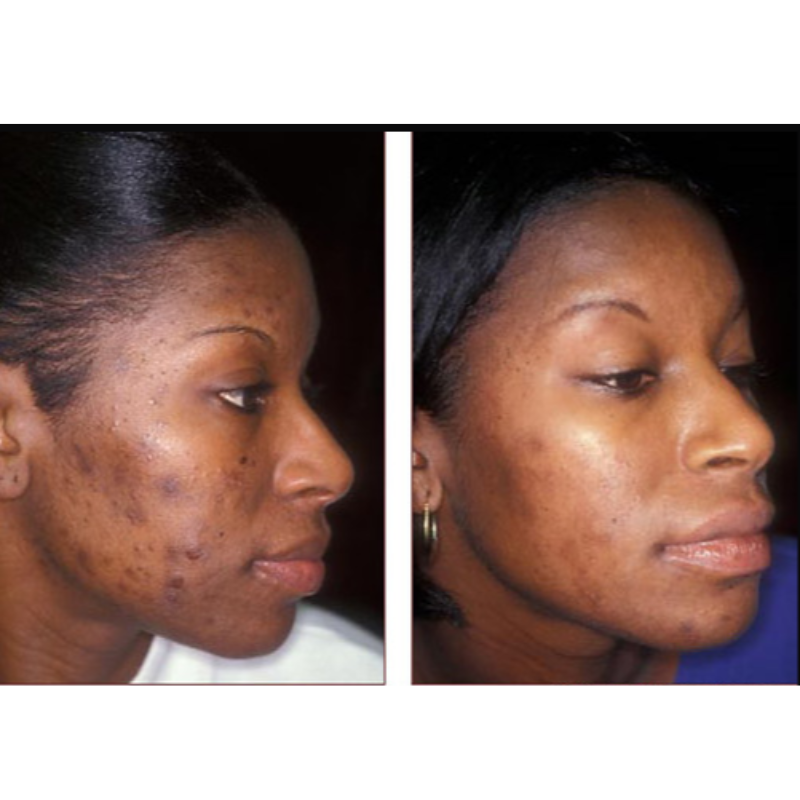 Renewal Facial Cleanser